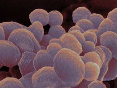 sexuellt överförbara sjukdomar,sexuellt överförbara sjukdomar statistik,sexuellt överförbara sjukdomar oralsex,sexuellt överförbara sjukdomar smittskyddslagen,sexuellt överförbara sjukdomar engelska,sexuellt överförbara sjukdomar test stockholm,sexuellt överförbara sjukdomar anmälningsplikt,sexuellt överförbara sjukdomar i sverige,sexuellt överförbara sjukdomar bakterier,sexuellt överförbara sjukdomar virus,sexuellt överförbara sjukdomar Test,mycoplasma genitalium antibiotika,mycoplasma genitalium test,mycoplasma genitalium resistens,mycoplasma genitalium flashback,mycoplasma genitalium icd 10,mycoplasma genitalium smittskyddsinstitutet,mycoplasma genitalium english,mycoplasma gravid,mycoplasma genitalium behandling,mycoplasma genitalium test,mycoplasma genitalium symptoms,mycoplasma genitalium treatment,mycoplasma genitalium latent,mycoplasma genitalium flashback,mycoplasma genitalium smitta,mycoplasma genitalium provtagning,mycoplasma genitalium doxyferm,mycoplasma genitalium resistens, Du kan läsa mer om vilka symtom olika könssjukdomar ger genom att klicka på länkarna.,Gonorré,Herpes i underlivet.,Hiv och aids.,HPV som ger kondylom.,Klamydia.,Mykoplasma i underlivet.,Syfilis.