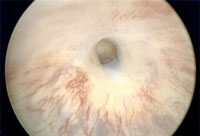 urologe,urologo,urolog,urologia,urologen,urolog stockholm,urologifocus,urolog liljeholmen,urolog skärholmen,urolog prostata,urolog stockholm,urolog liljeholmen,urolog skärholmen,urolog odenplan,urolog utan remiss,urolog bergshamra,urolog sabbatsberg,urolog södertälje,urolog nacka,urolog sös,urolog stockholm privat,urolog stockholm sophiahemmet,urolog stockholm drottninggatan,urolog stockholm akut,urolog stockholm östermalm,urolog stockholm odenplan,urolog stockholm sabbatsberg,urolog stockholm bergshamra,urolog stockholm liljeholmen,urolog stockholm hötorget,urolog stockholm utan remiss,